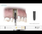 Dentsply Sirona Implants Global