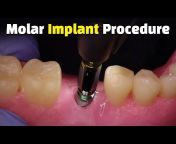 Dental Procedures Explained