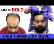 Hairfree u0026 Hairgrow Hair Transplant Clinic