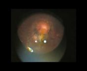 Dr Abhishek Kothari-Pink City Eye u0026 Retina Center