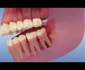 Dental Video