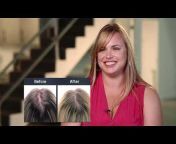 Igrow Laser Hair Growth Systems