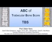TBS Osteo by Medimaps Group