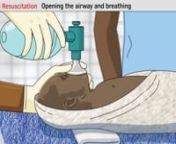 This film shows how to deliver and care for a newborn baby and how to resuscitate a newborn that is not breathing using a bag and mask.nnThis film is for use in health worker training