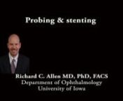 This is Richard Allen at the University of Iowa. This video demonstrates a probing and stenting of a child with congenital nasolacrimal duct obstruction.A punctal dilator is introduced into the lower punctum.And the same is performed on the upper punctum.The dilator is first introduced vertically followed by horizontal advancement. A bowman probe is then placed.I usually start with either a 0 or 1 bowman probe.Again, placed vertically and then horizontally in order to appreciate a ha