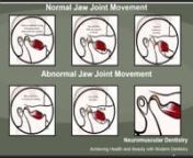 http://www.DrTimmerman.com nPlain text transcript:nTalk a little bit about TMJ disorders, TMJ pain. There are a lot of words out there to describe TMJ therapy. What it is, TMD, temporomandibular disorder. Those of us that treat TMJ issues always get a kick out of when people say,
