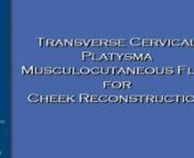 Dr Stephan Ariyan - TRANSVERSE CERVICAL PLATYSMA MUSCULOCUTANEOUS FLAP FOR CHEEK RECONSTRUCTION- 8min- 2011 from ariyan
