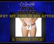 A tummy tuck surgery helps people who want to remove excess skin and fats under the tummy, following enormous weight loss or pregnancy.This procedure will give you a slimmer, tighter looking tummy. After the procedure, the tummy may appear flat in appearance. Most of the time there will be some swelling but it will eventually disappear.You need to understand that even for a tummy tuck, I also address the other problem areas of the body that may affect the overall aesthetic appearance. When I