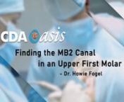 Finding the MB2 Canal in an Upper First Molar from mb2
