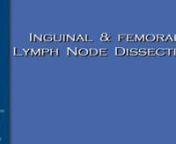 Dr Stephan Ariyan -LYMPH NODE DISSECTION-INGUINAL & FEMORAL- 12min- 2008 from ariyan
