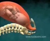 Animación médica 3D parto vaginal normal