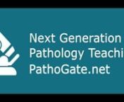 Interactive Teaching PathoGate.net.mp4 from patho