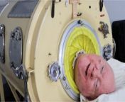 USA: Man who lived with an 'iron lung' due to polio dies aged 78 from 10 age of love