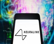 Another update from Neuralink this week as the Elon Musk startup released a video yesterday of a patient using a brain implant to move a mouse and play chess.The 29-year-old patient is the first human to ever receive a Neuralink implanted device in his brain.