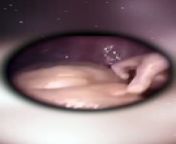How we live inside the womb from 8 baby born in the caul